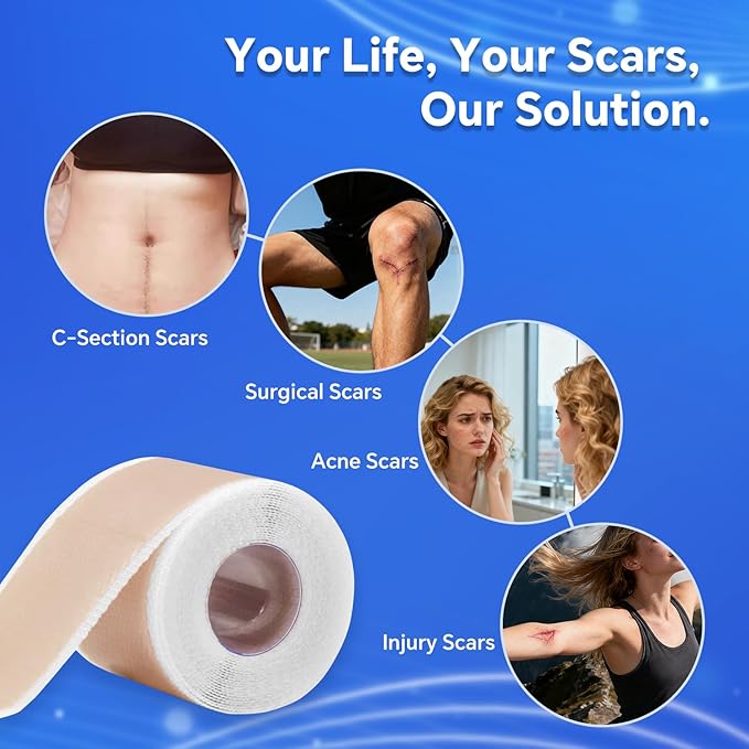 Professional Silicone Scar Sheets, Silicone Scar Tape, Silicone Scar Patch, Reusable Scar Silicone Strips (1.5M)