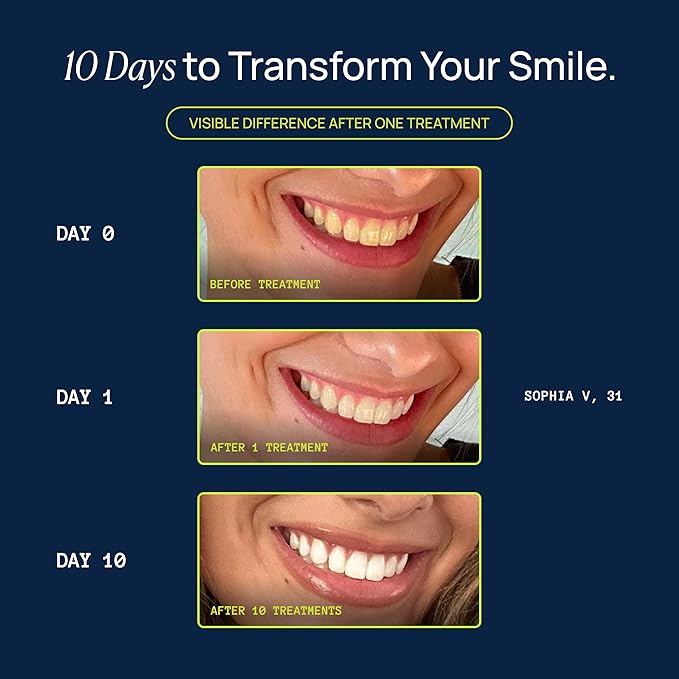 Laughland Everyday to Go Whitening Teeth Pen, Formula with 8% Hydrogen Peroxide, Glycerin, Aloe Vera & Mint, Gentle on Sensitive Teeth, at Home Dental Care, Travel Friendly, 6 Treatments